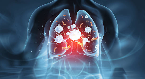 respiratory infection